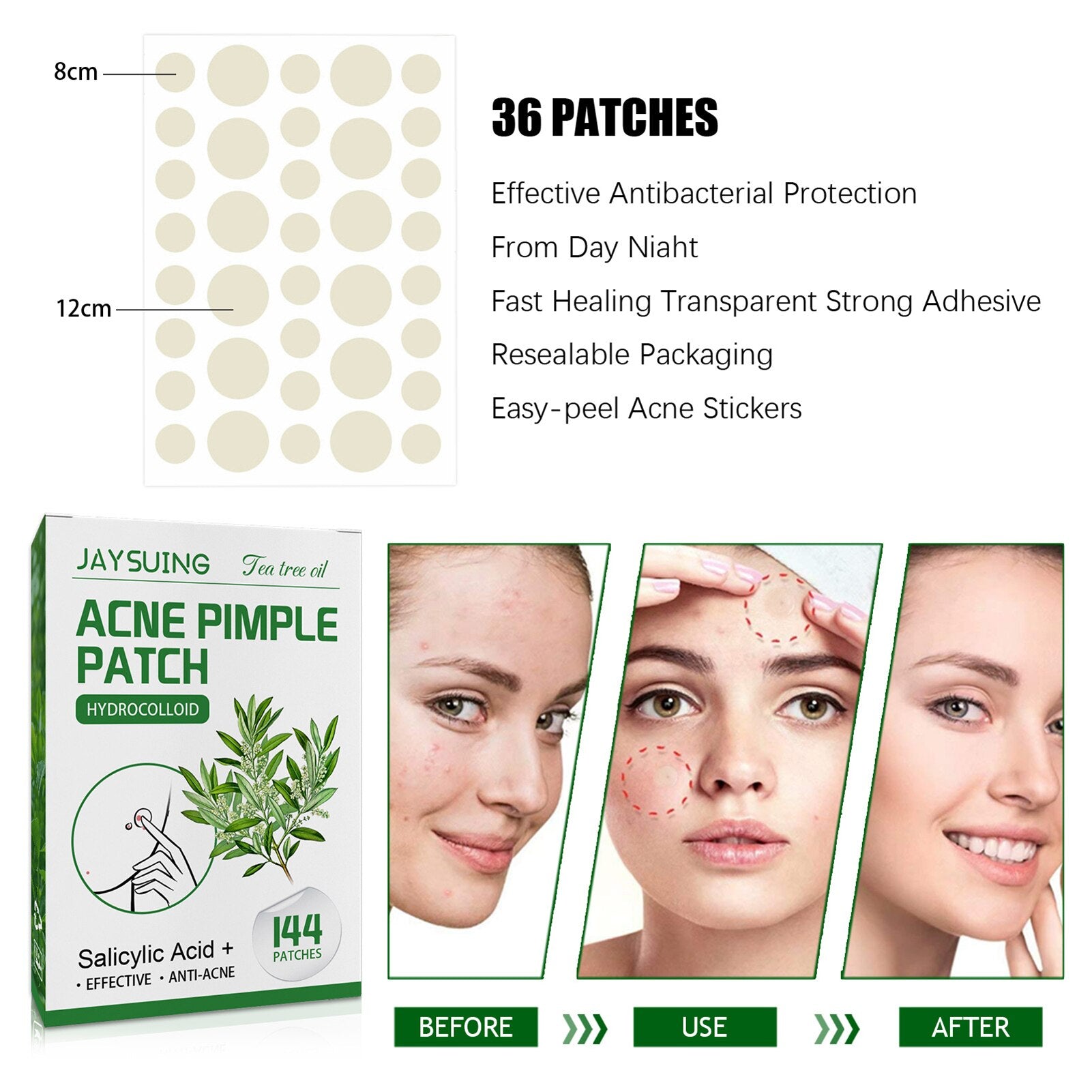 whitehead remedy, acne treatment, acne patches, tree tea oil patch, blemish, acne stickers, acne patch